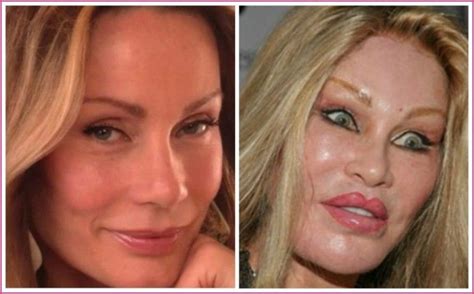 jocelyn wildenstein before and after.